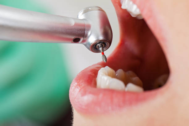 Best Emergency Denture Repair in Scott City, KS